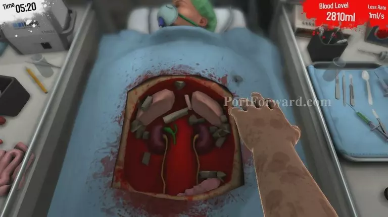 Surgeon Simulator 2013 Walkthrough - Surgeon Simulator-2013 58