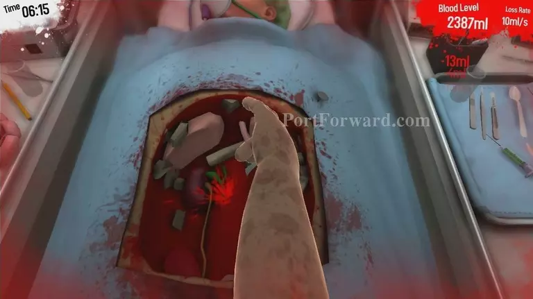 Surgeon Simulator 2013 Walkthrough - Surgeon Simulator-2013 59